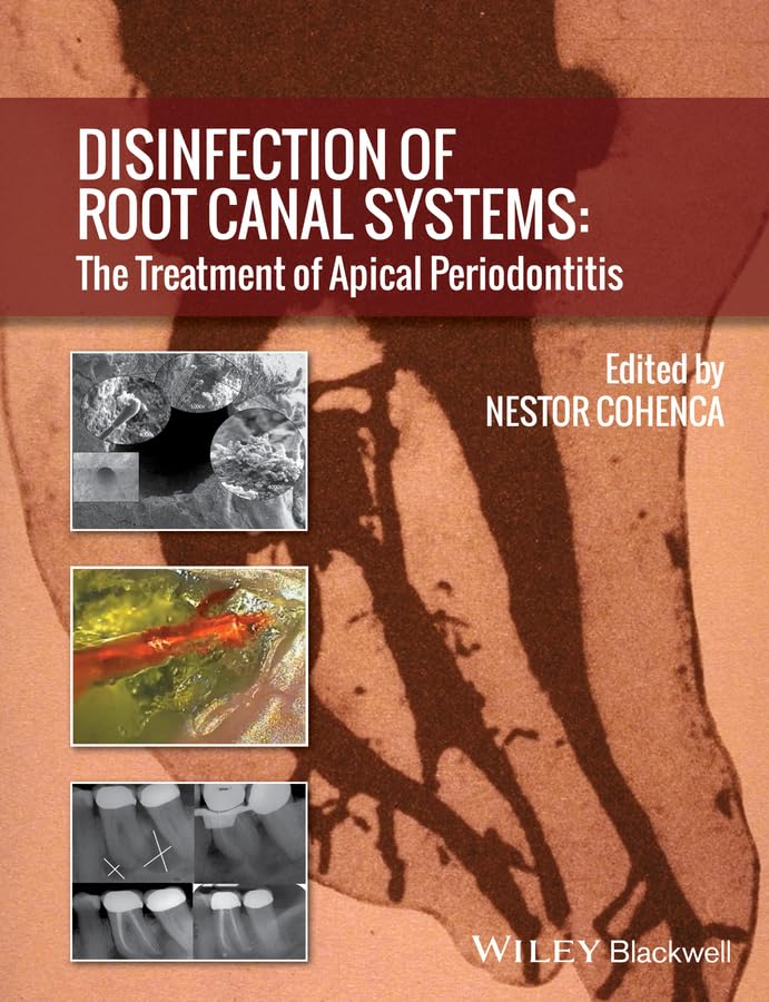 Root Canal Disinfection Kit for Apical Periodontitis Treatment | Effective Dental Sterilization Tools for Endodontic Therapy | Perfect for Dentists & Dental Clinics