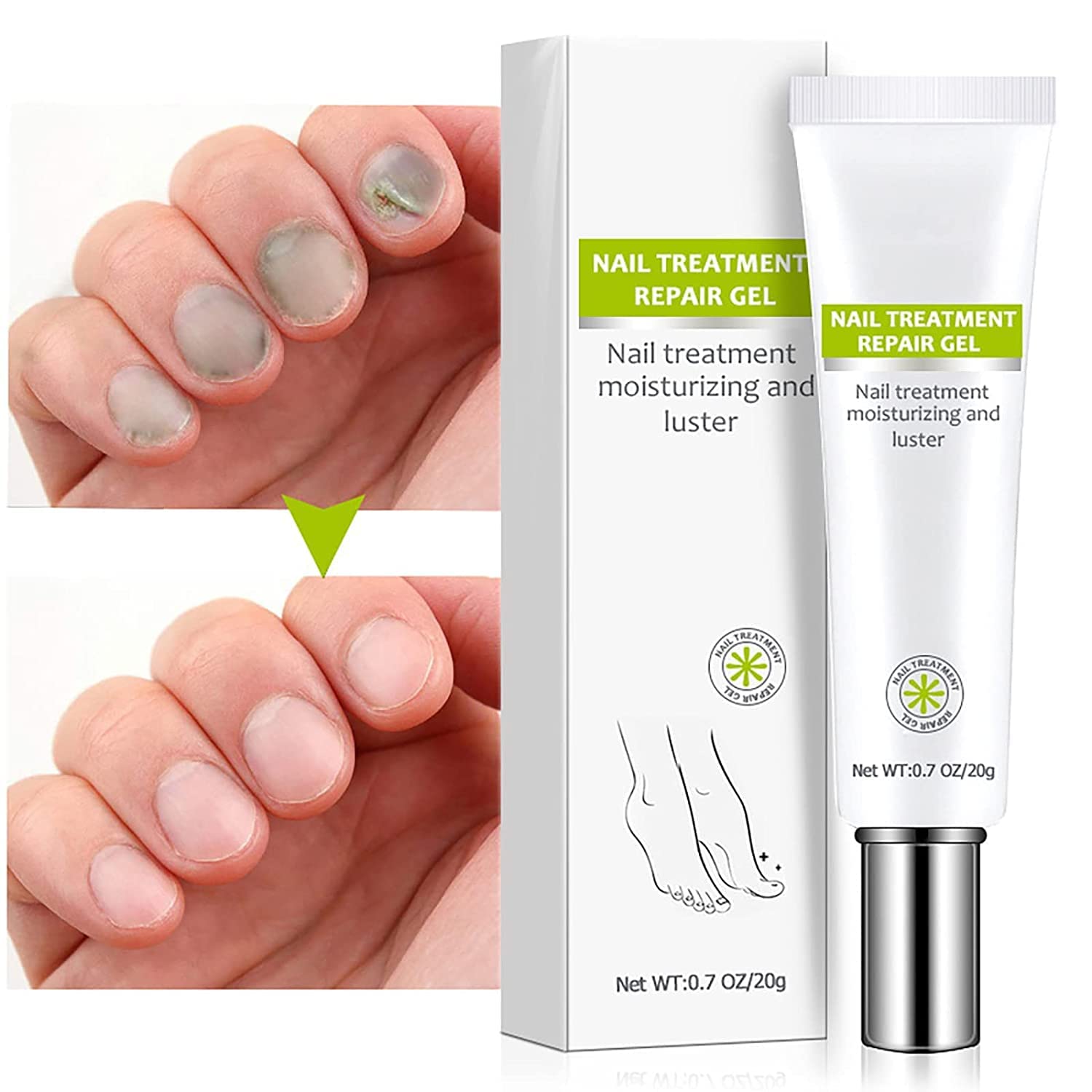 Flyles Nail Repair Treatment Gel - Restores Discolored & Damaged Nails, Strengthens & Protects Natural Nails (2 Pack) | Perfect for Manicures, Nail Care Routine & Salon Treatments