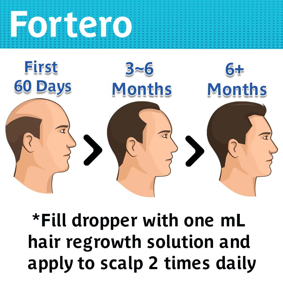 5% Minoxidil Hair Regrowth Treatment for Men - Anti-Hair Loss Formula for Pattern Baldness & Alopecia | Stops Hair Fall, Promotes Thicker Hair Growth | 2 fl Oz (3 Pack) | Perfect for Daily Use at Home or Travel