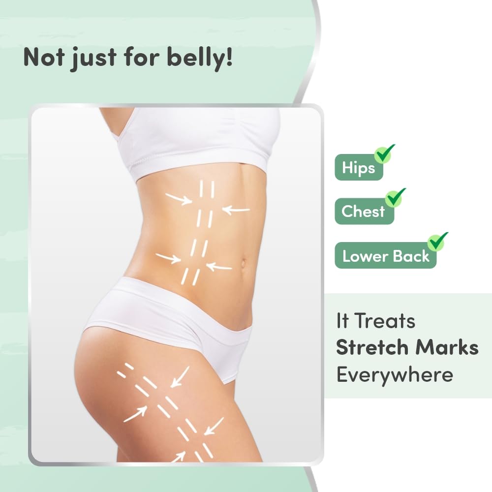 **Mylo Care Stretch Marks Oil with Sea Buckthorn, Rosehip, Argan & Coconut Oil – Vitamin E Oil for Scars & Stretch Mark Removal – Natural Skin Care Solution for Pregnant Women & Postpartum – 100ml – Perfect for Pregnancy, Postpartum & Daily Skin Hydration**