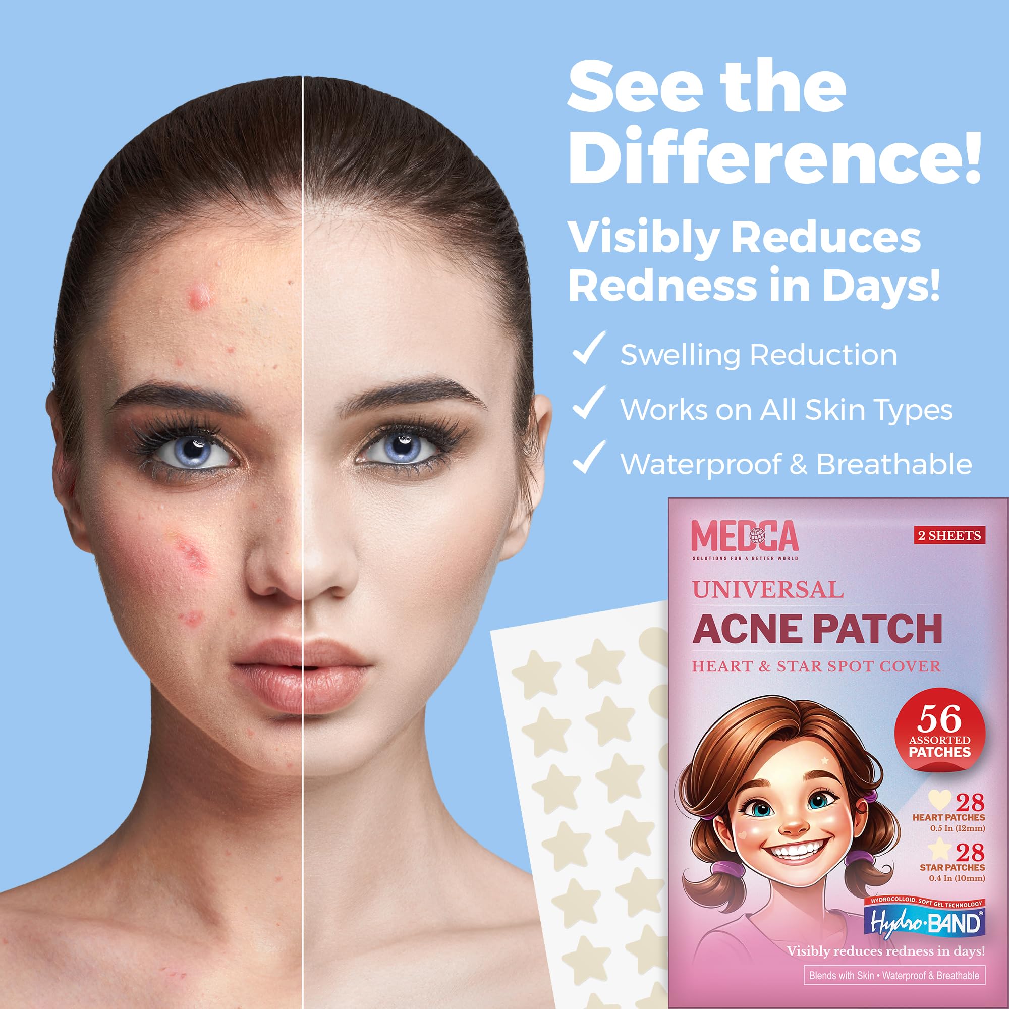 MEDca Acne Patches (56 Count) - Hydrocolloid Pimple Spot Treatment for Face, Absorbing Zit Cover Dots in Heart & Star Shapes | Perfect for Overnight Acne Treatment & Teen Skincare Care