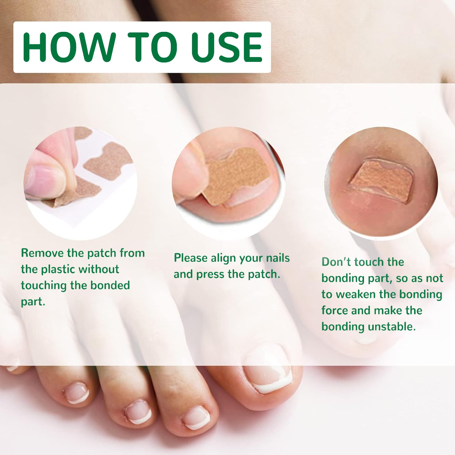 50 Pcs Ingrown Toenail Corrector Patches - No Glue Breathable & Painless Nail Correction Treatment, Stays on Securely for Quick Repair | Ideal for Athletes, Runners & Daily Comfort