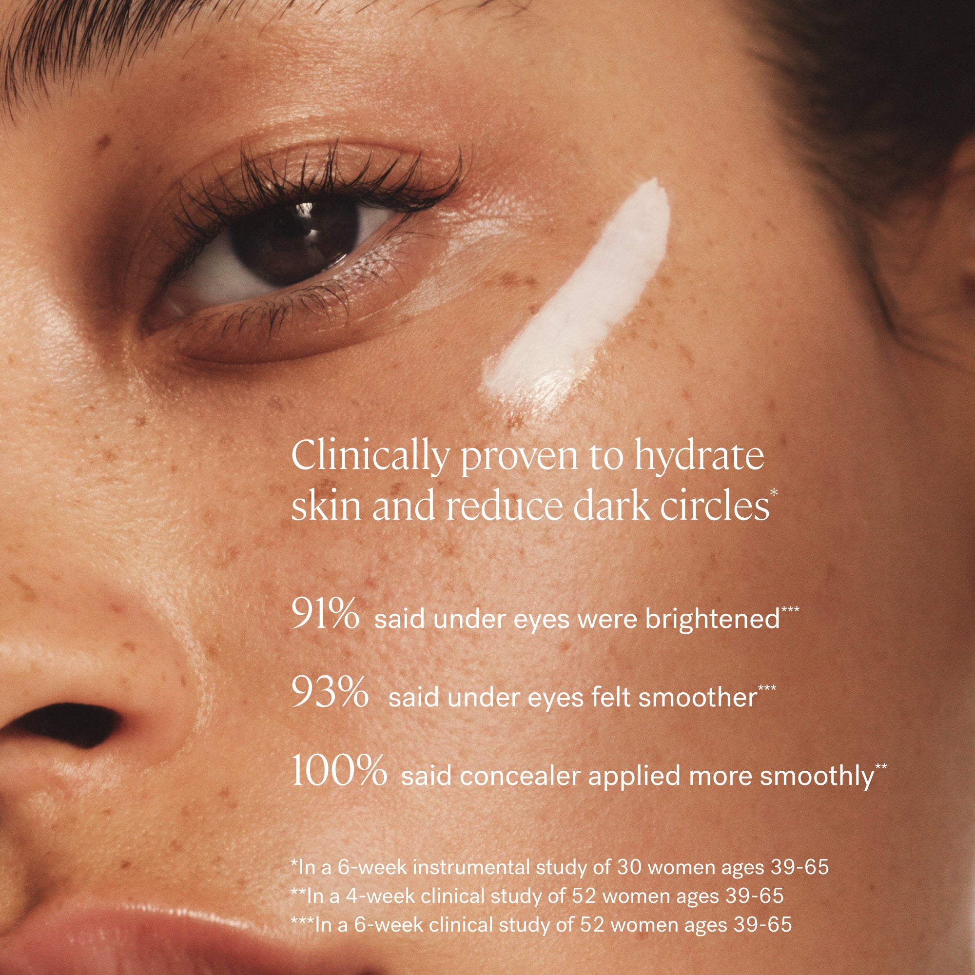 Bright Start Activated Eye Cream for Dark Circles & Wrinkles - Anti-Aging Eye Treatment for Puffiness & Fine Lines - Perfect for Morning & Night Skincare Routine