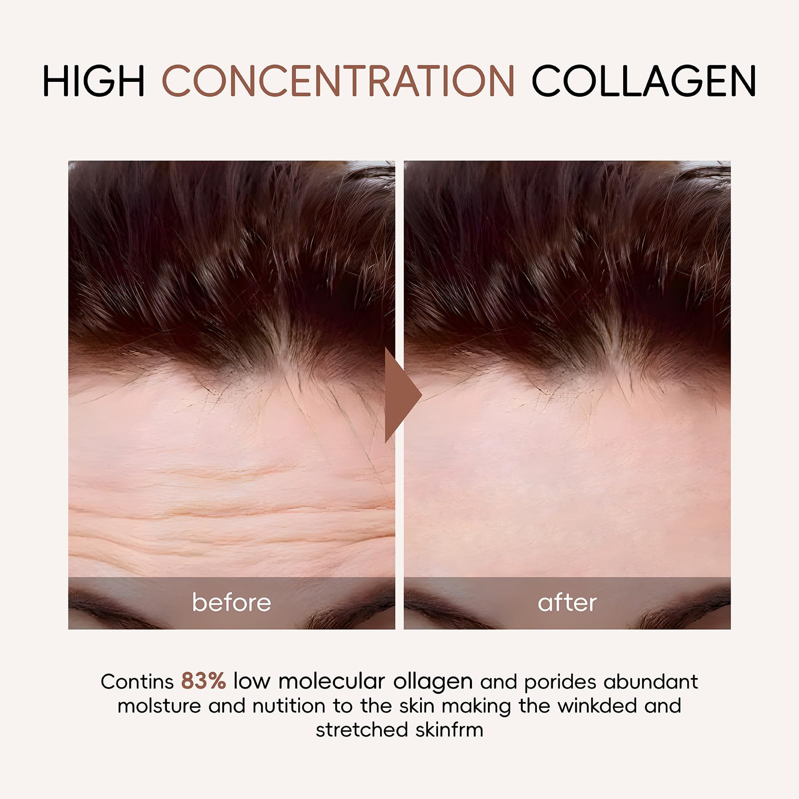 Deep Collagen Anti-Wrinkle Lifting Face Mask | Korean Bio-Collagen Overnight Treatment for Wrinkles & Firming (5 Pack) - Perfect for Nighttime Skincare Routine & Spa Days