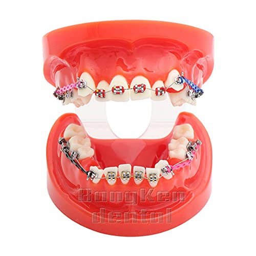 Typodont Tooth Model - Standard Orthodontic M3005R for Dental Teaching & Training (1Pc) | Perfect for Dental Schools, Orthodontic Practices & Educational Demonstrations