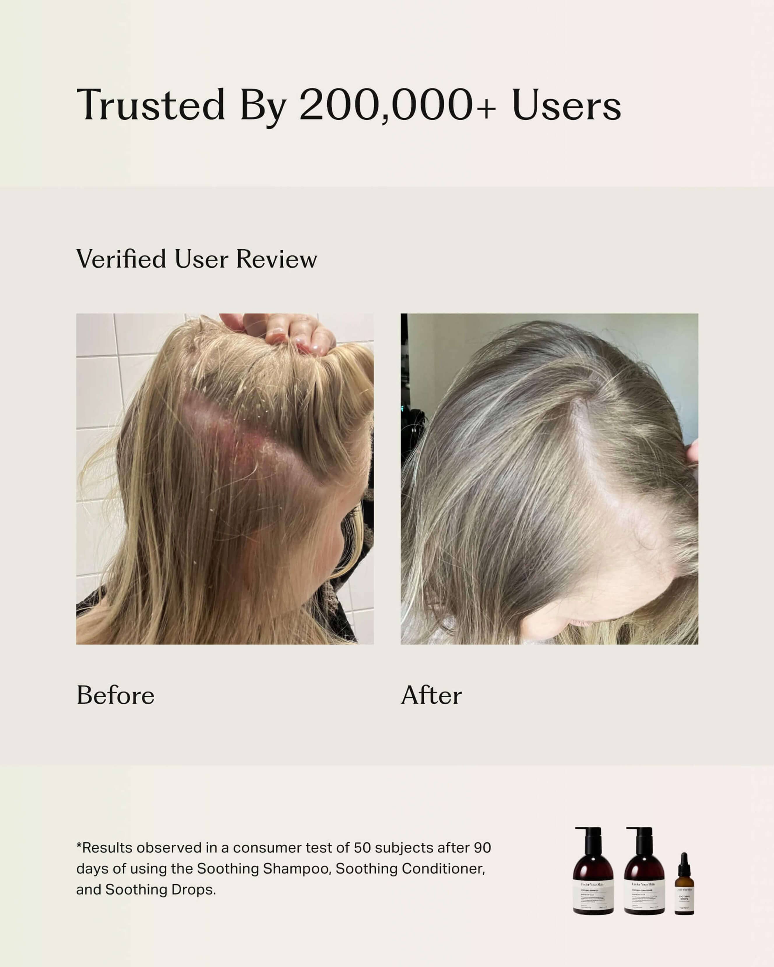 Soothing Scalp Treatment Conditioner for Dry & Itchy Scalp - Hydrating Hair Care with Natural Oils - Perfect for Daily Use & Post Hair Coloring