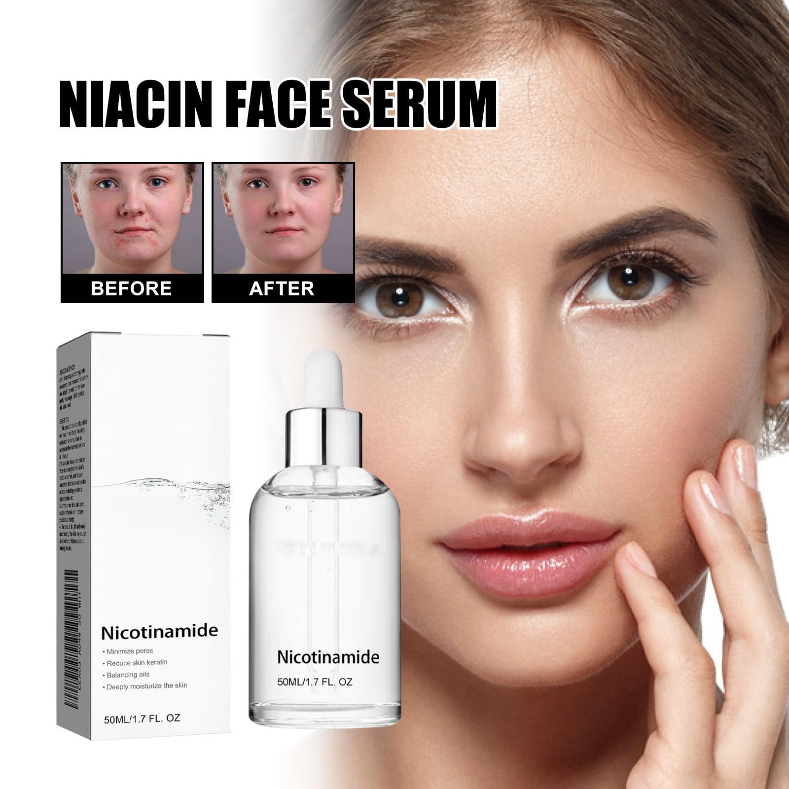 Niacinamide Serum for Freckles & Blemish Removal - Brightening Facial Treatment for Dark Spots & Hyperpigmentation | Perfect for Daily Skincare Routine & Nighttime Use