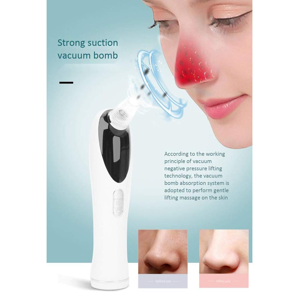 Qutsvosh Blackhead Remover Vacuum - Deep Pore Cleanser for Acne & Pimple Removal - Facial Spa Skin Care Beauty Tool (Green) - Perfect for At-Home Skincare Routine & Spa Treatments
