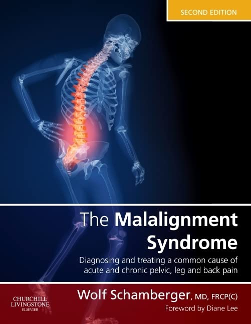 Malalignment Syndrome: Diagnosis & Treatment for Common Pelvic & Back Pain Relief - Ideal for Chiropractors, Physical Therapists & Pain Management