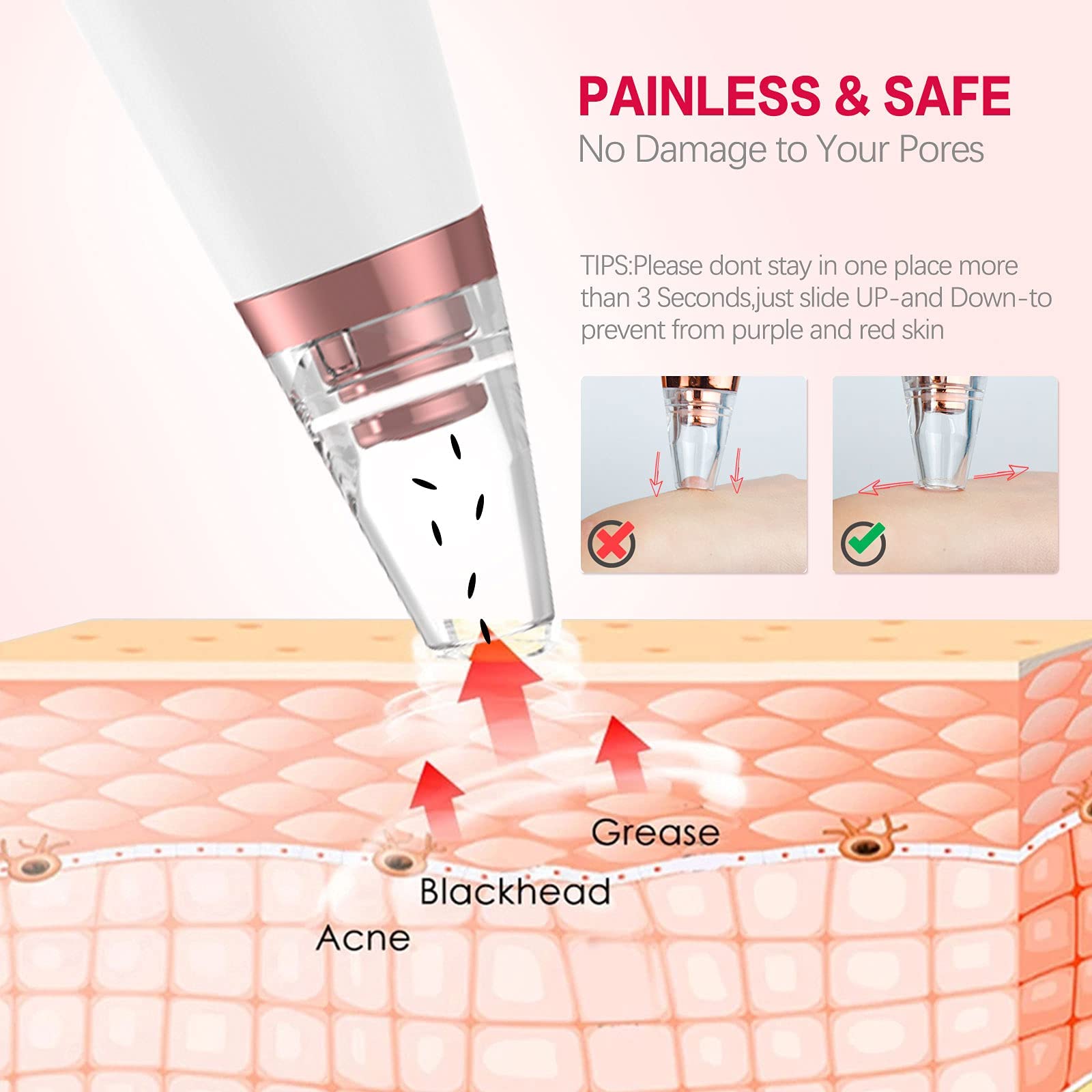 Blackhead Remover Pore Vacuum - 3 Modes, 5 Probes, USB Rechargeable for Clear Skin