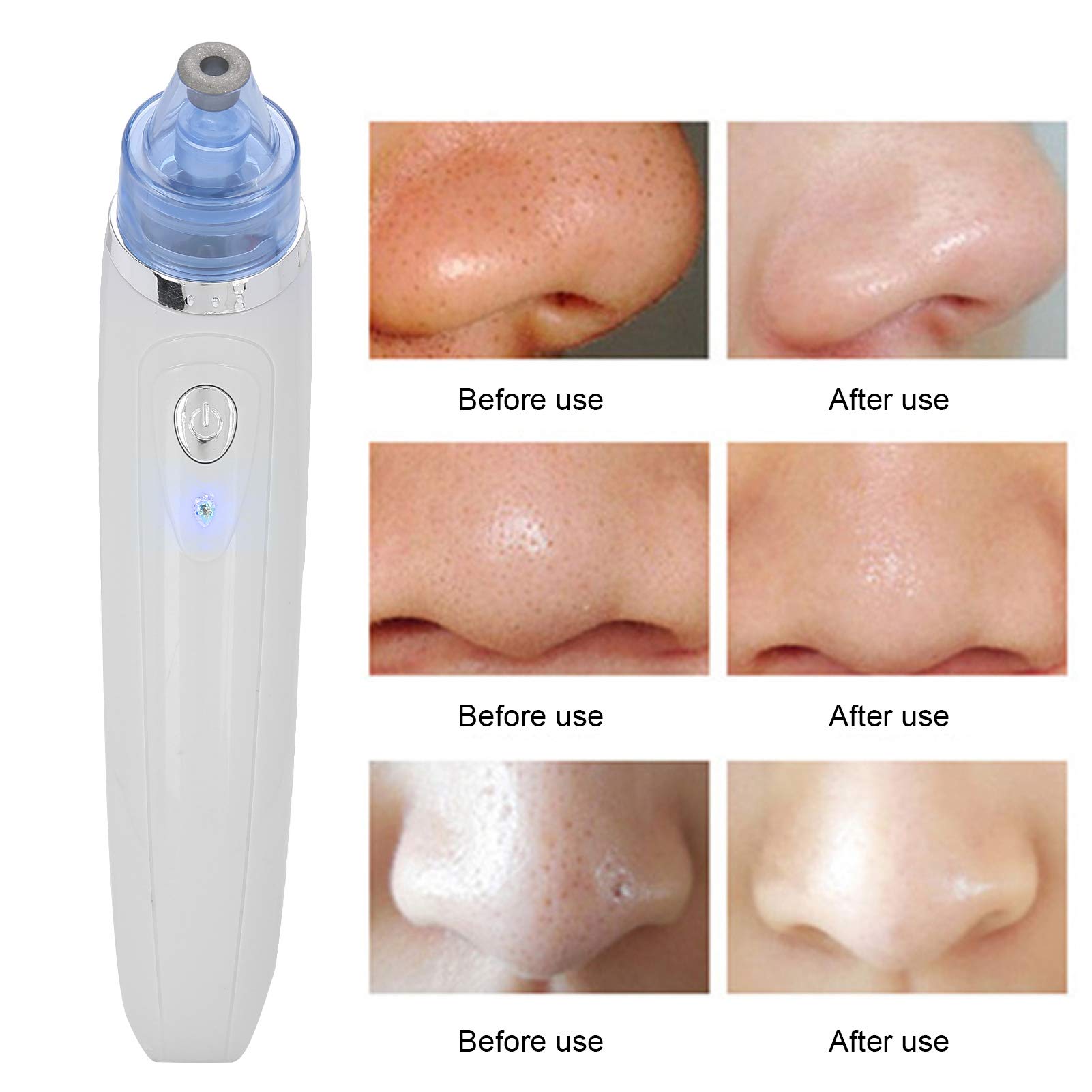 Blackhead Remover Vacuum with 4 Probes - 3 Adjustable Suction Levels for Deep Pore Cleansing at Home