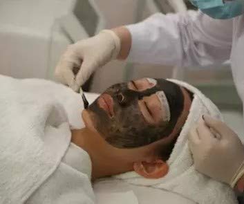 Professional Carbon Peel Gel for Q-Switch Nd:YAG Laser - 80ml Skin Rejuvenation Treatment, Deep Facial Cleansing & Blackhead Removal - Ideal for Spa, Clinic & At-Home Skincare Routine