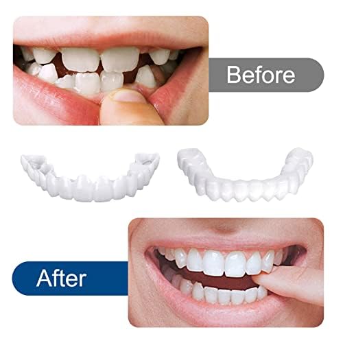 3 Pairs Snap-On Veneers for Instant Teeth Whitening & Smile Makeover - Comfort Fit Temporary Veneers for Men & Women - Perfect for Parties, Weddings & Confident Smiles - Protects Natural Teeth While Enhancing Your Look