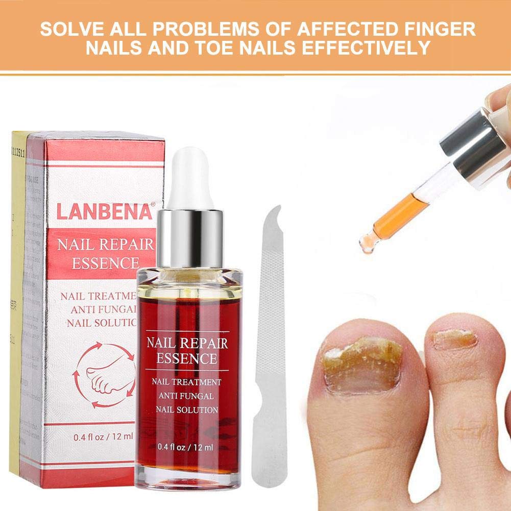 12ml Nail Repair Essence Set - Powerful Nail Strengthener & Cuticle Treatment with Nail File | Professional Nail Care Kit for Damaged, Weak & Brittle Nails | At-Home Salon Treatment & DIY Manicure Solution