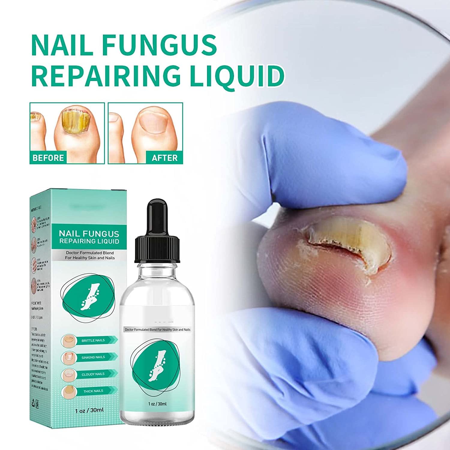 Kerassentials Toenail Fungus Treatment Oil - Healthy Skin & Nail Care Solution (1 Pack) - Effective for Athlete's Foot, Nail Fungus & Dry Skin Relief
