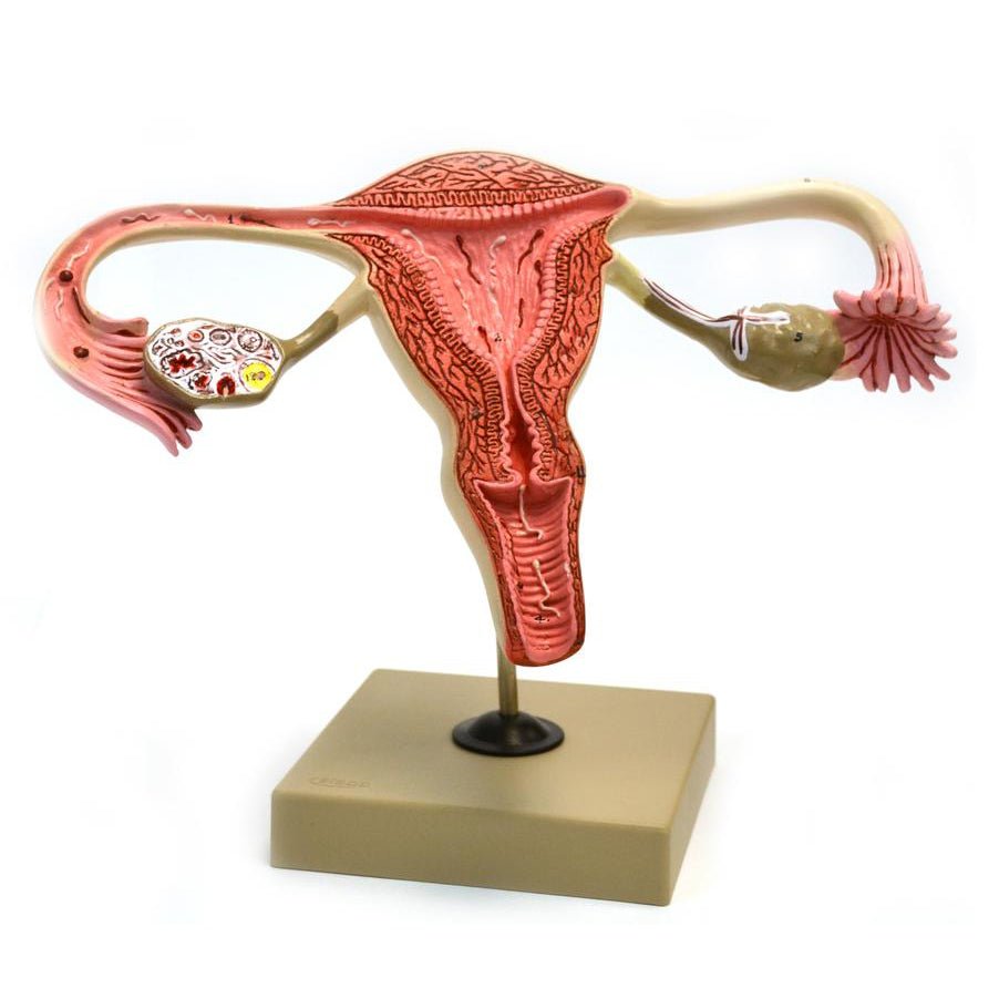 Female Reproductive Organs - Anatomy Model for Medical Education, Nursing Students & Healthcare Professionals | Study, Classroom & Clinical Training Use