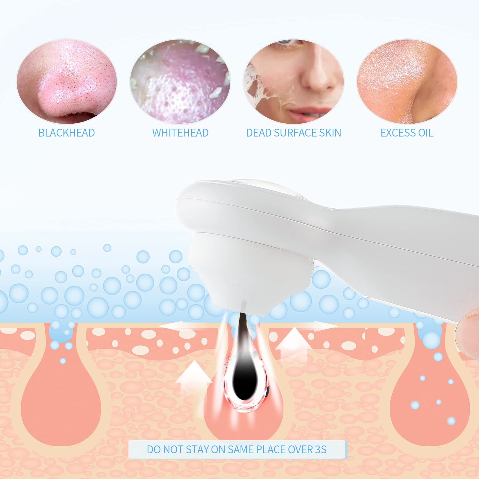 ForeverLily Blackhead Vacuum Remover - Professional Nose Pore Cleaner with Magnifier & LED Light - Facial Blackhead Extractor Tool for Deep Cleansing - Perfect for Home Spa & Skincare Routine