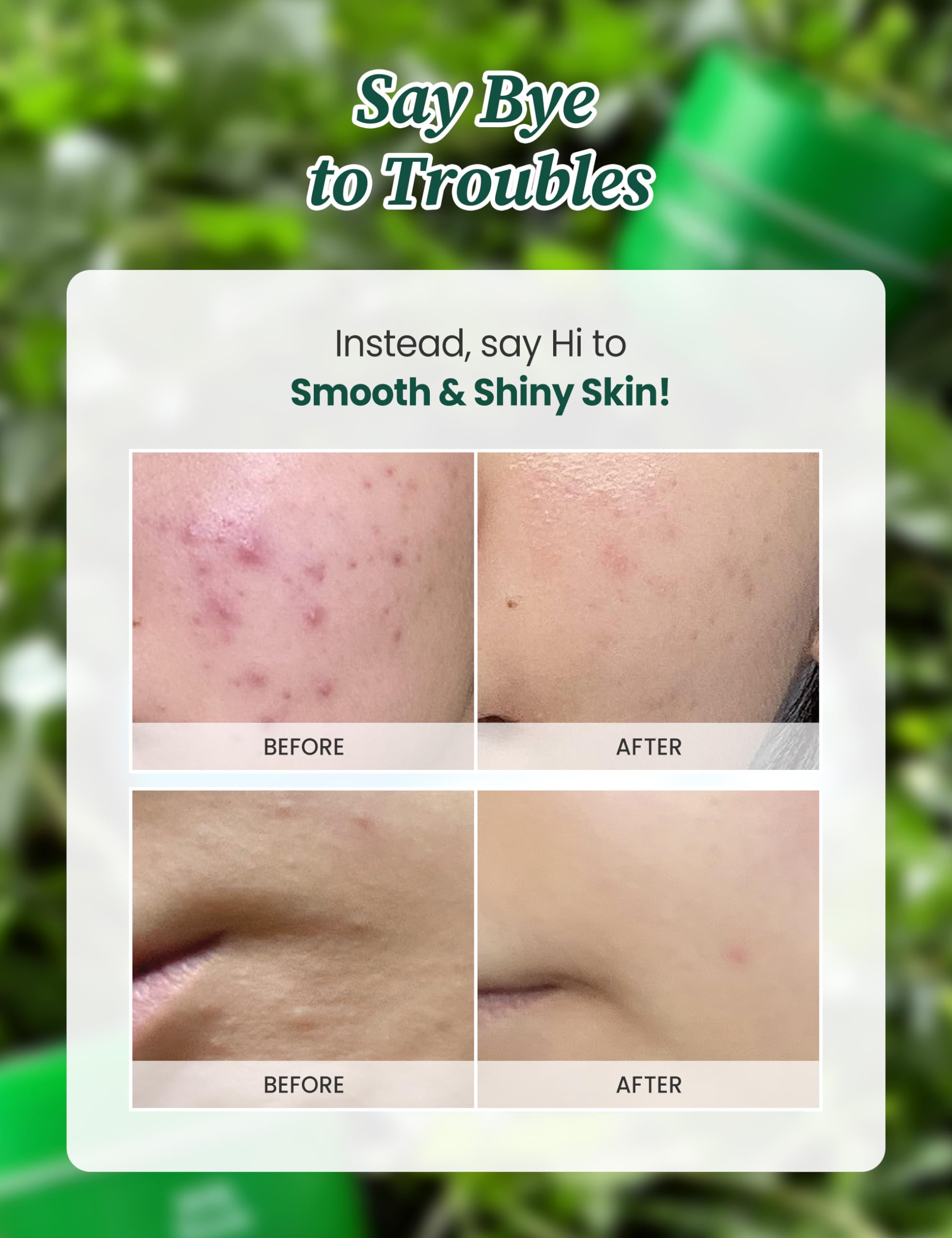 MILKTOUCH Hedera Helix Relaxing Cream Jumbo 3.38 oz - Redness Relief & Hydrating Face Moisturizer for Sensitive Skin with Cica Extract, Soothes Rosacea & Calms Irritation - Perfect for Daily Skincare Routine & Post-Treatment Care