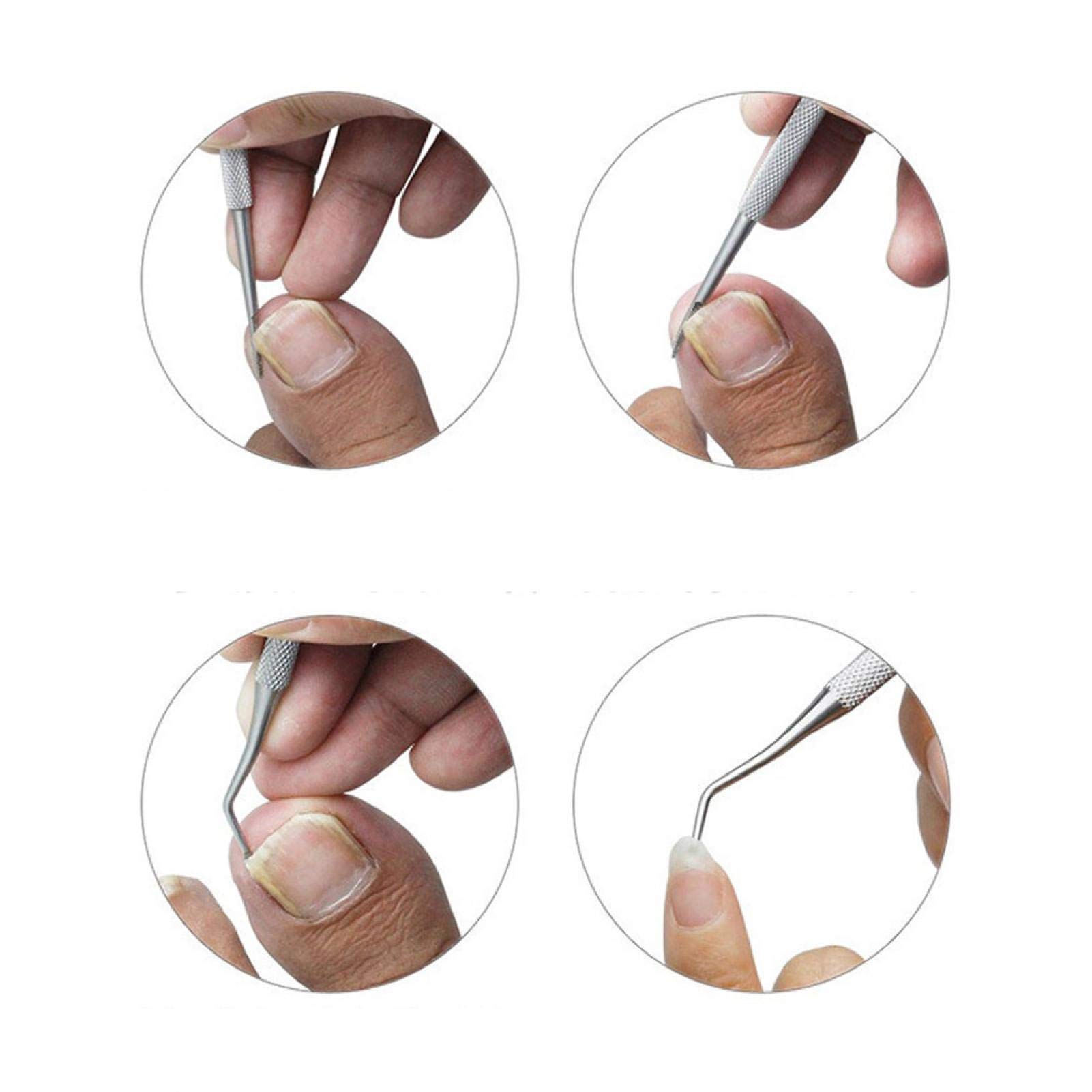 Premium Stainless Steel Toe Nail Clippers for Thick & Ingrown Toenails - Ergonomic Grip Handle Nail Clipper Set with Nail Scissors & File - Ideal for Seniors, Men & Adults - Perfect for Home Pedicure & Foot Care