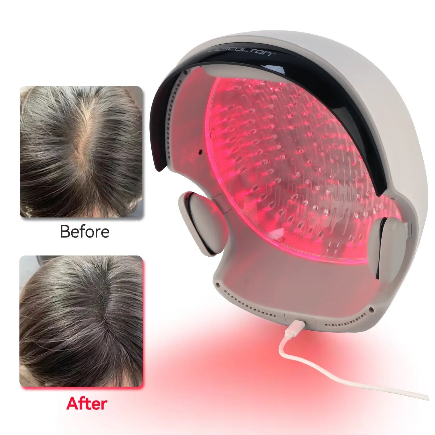 VolumeMax Hair Growth Helmet with 162 Laser Diodes - FDA Cleared for Hair Regrowth & Thinning - At-Home Laser Therapy for Men & Women