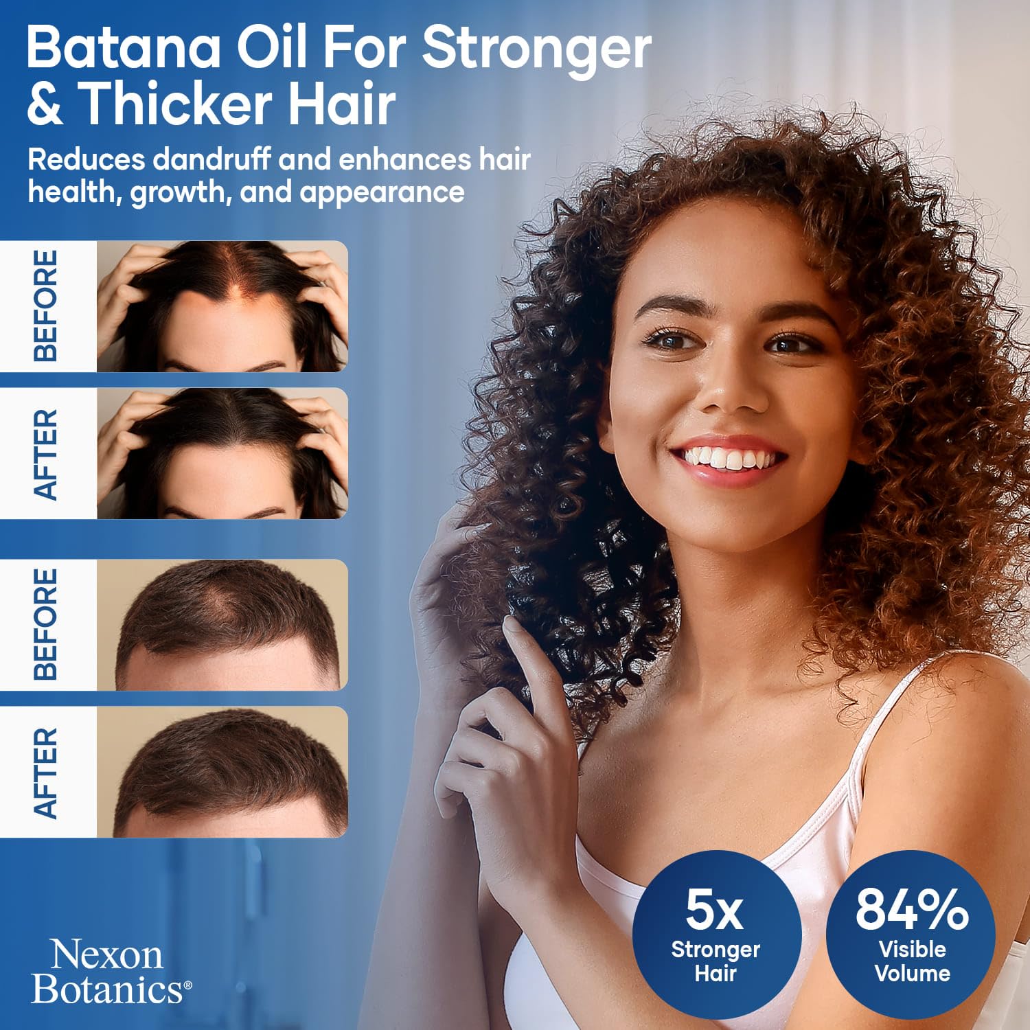 100% Pure Raw Batana Oil for Hair Growth - 4 fl oz Cold-Pressed Natural Oil for Hair, Skin, Face & Eyelashes - Organic Hair Treatment for Dry Scalp & Damaged Hair - Perfect for Night Routine & DIY Beauty Recipes