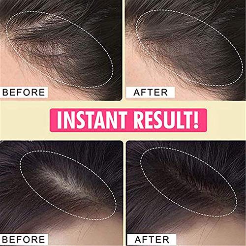 Volume Max Waterproof Hair Shading Powder - Hairline Shadow & Filler for Thinning Hair | Magical Fluffy Hair Powder (B+C+D) | Instant Coverage for Bald Spots & Scalp Concealer | Perfect for Daily Use, Special Occasions & Hair Styling