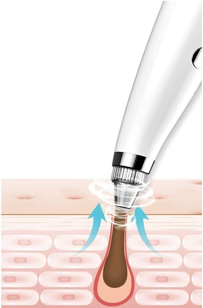 Electric Blackhead Remover Vacuum - 6 Adjustable Suction Probes for Deep Pore Cleaning, Acne Treatment & Facial Extraction | Perfect for Home Skincare & Spa Treatments