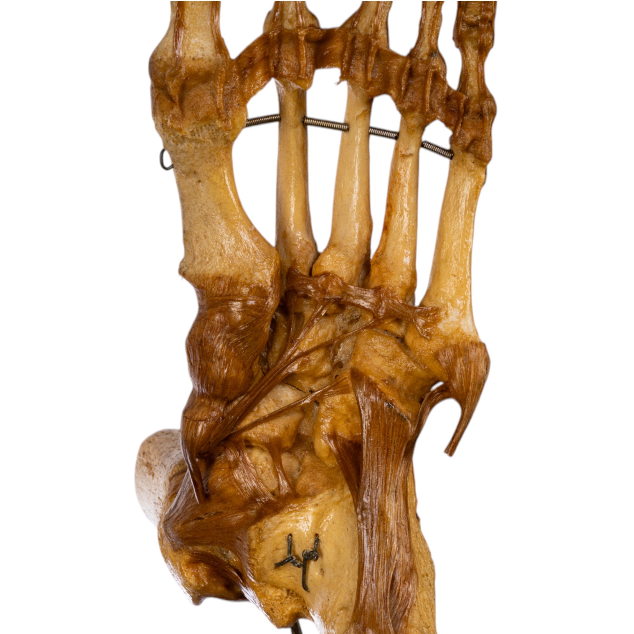 Real Human Foot and Ankle Joint Anatomy Model with Stand - Perfect for Medical Education, Classroom Demonstrations & Orthopedic Study
