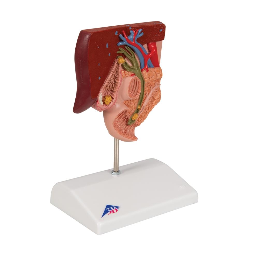 Gallstone Model with 3B Smart Anatomy K26 - Medical Teaching Tool for Human Digestive System Study & Classroom Demonstration