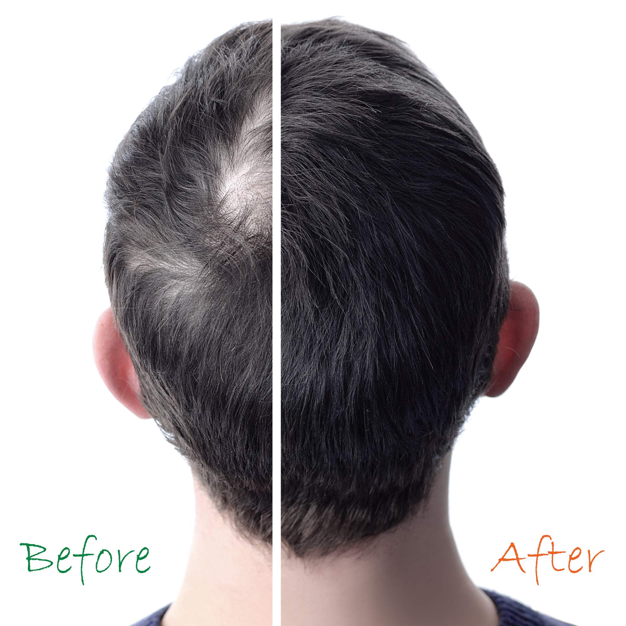 Organic Hair Growth Booster & Energizer - 6 Oz | Natural Hair Thickening Treatment for Men & Women | Perfect for Daily Use, Hair Loss Prevention & Scalp Care