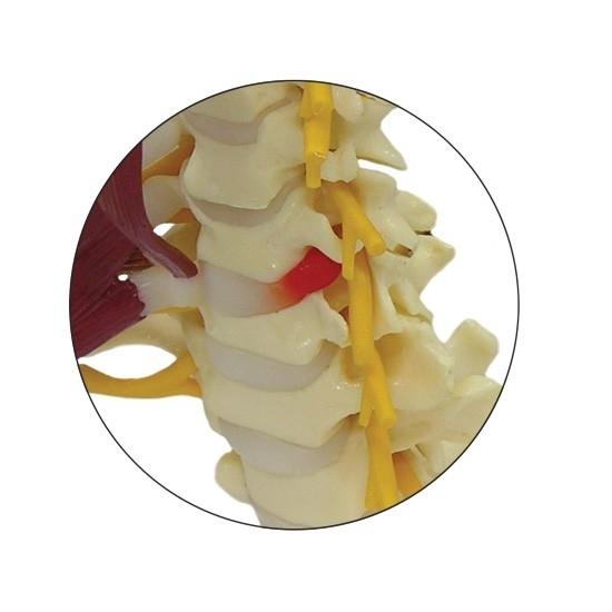 Premium Human Cervical Spine Model with Muscles - Detailed Anatomical Study Tool for Medical Students & Chiropractors - Perfect for Classroom, Clinic & Patient Education