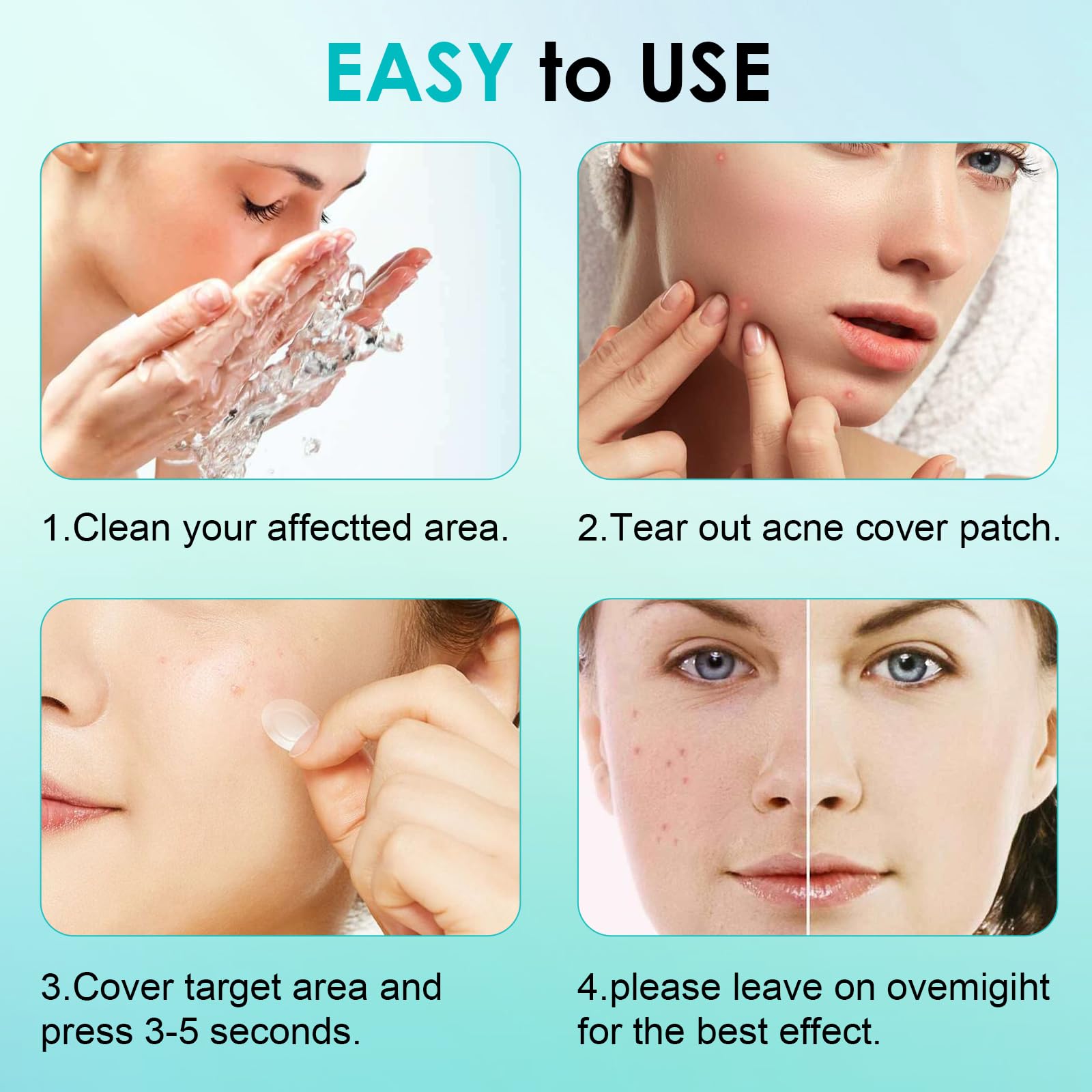 264PCS Pimple Patches for Acne Treatment - Fast Acting Absorbing Spot Patches, Invisible Blemish Cover for Day & Night Use - Perfect for Face, Back & Body Acne Care