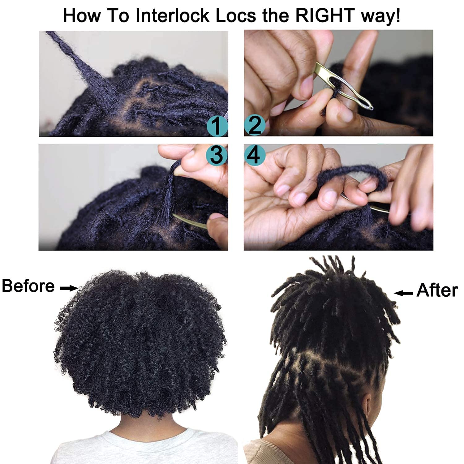 NAYOO 5-in-1 Dreadlock Tool Kit - Interlocking Needle for Starting & Maintaining Locs (5 Piece Set, Silver) | Perfect for Salon Professionals & Home Hair Care