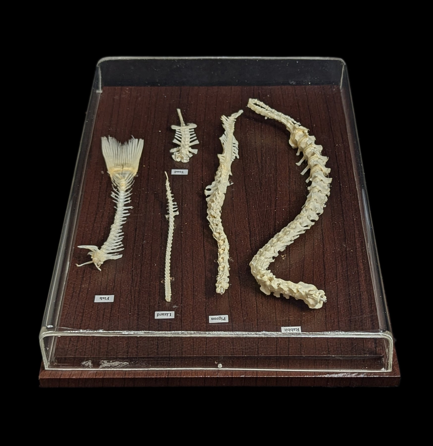 Spinal Column Comparisons - Anatomy Models for Medical Students & Professionals | Perfect for Study, Teaching & Clinical Reference