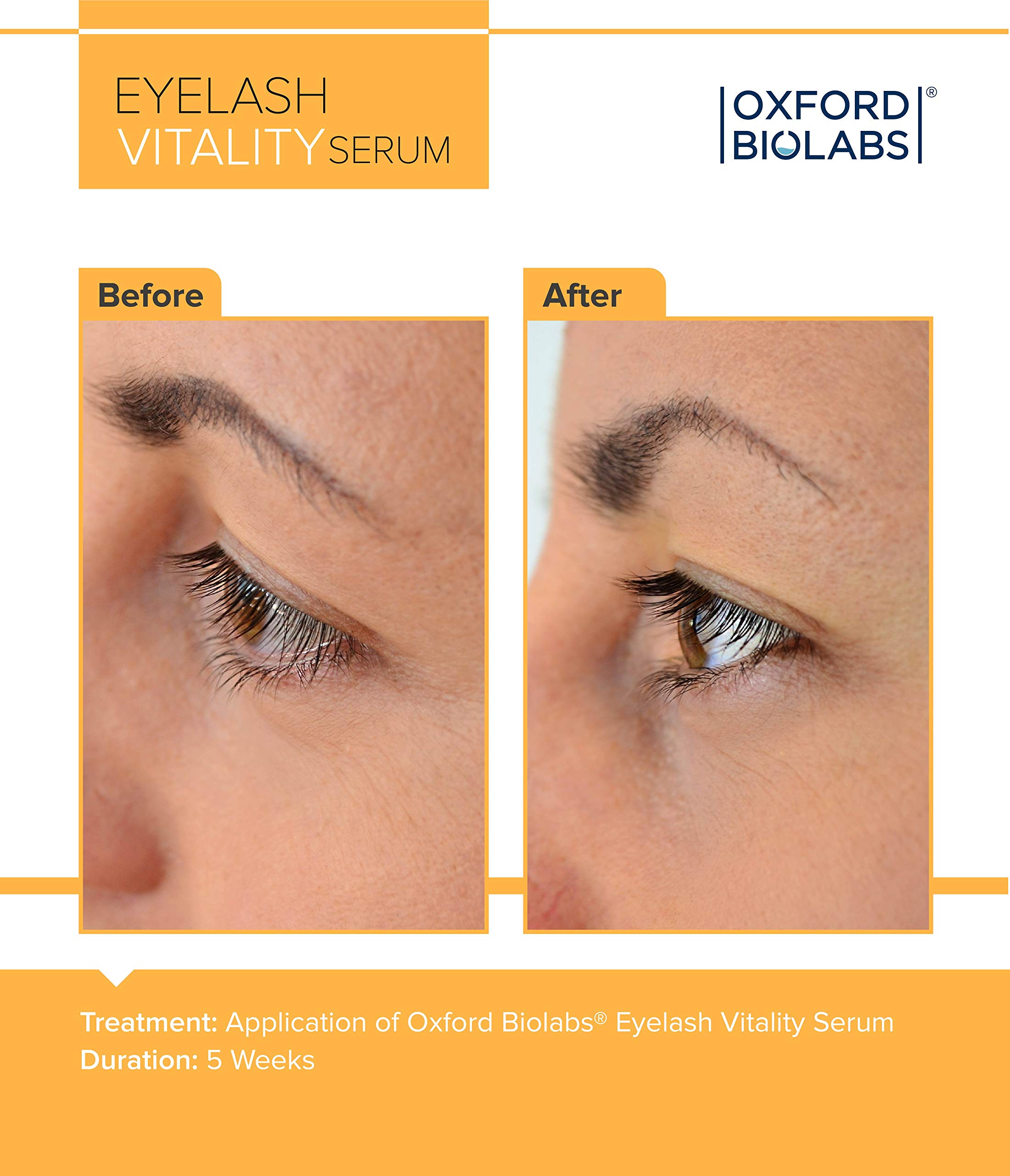 Oxford Biolabs Eyelash & Brow Growth Serum - Natural Lash Enhancing Formula for Longer, Thicker Lashes & Brows | Perfect for Daily Use & Special Occasions