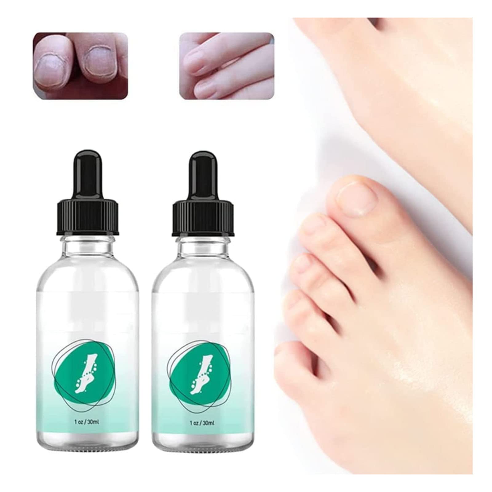 Effective Toenail Fungus Treatment Oil - Natural Tea Tree Oil for Mycosis & Nail Fungus (2 Pack) - Perfect for Athletes Foot, Discolored Nails & Fungal Infections at Home