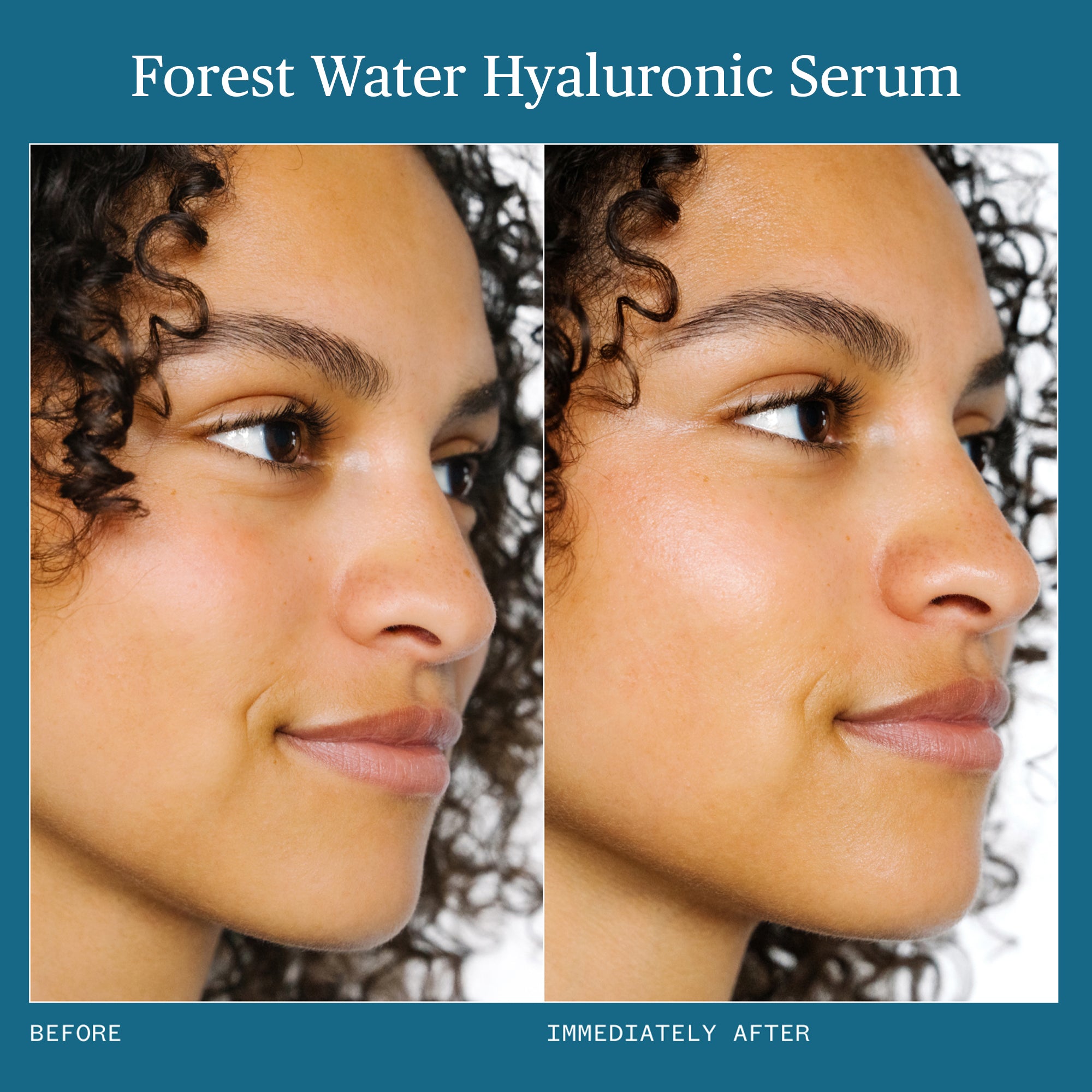 Forest Water Hyaluronic Acid Serum for Face - Hydrating & Plumping Anti-Aging Skincare - Perfect for Dry Skin & Daily Moisturizing Routine