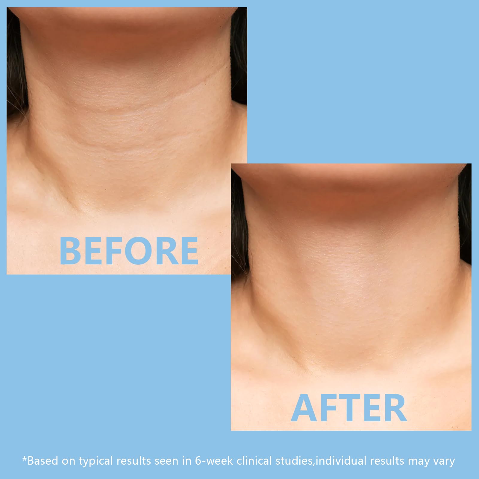 KISSIO 5% Collagen Complex Neck Firming Cream - Anti-Aging Neck Tightening Cream with Peptides & Aloe Vera for Lifting, Hydration & Wrinkle Reduction - All Skin Types - 2.12 Oz - Perfect for Night Routine & Daily Skincare Regimen