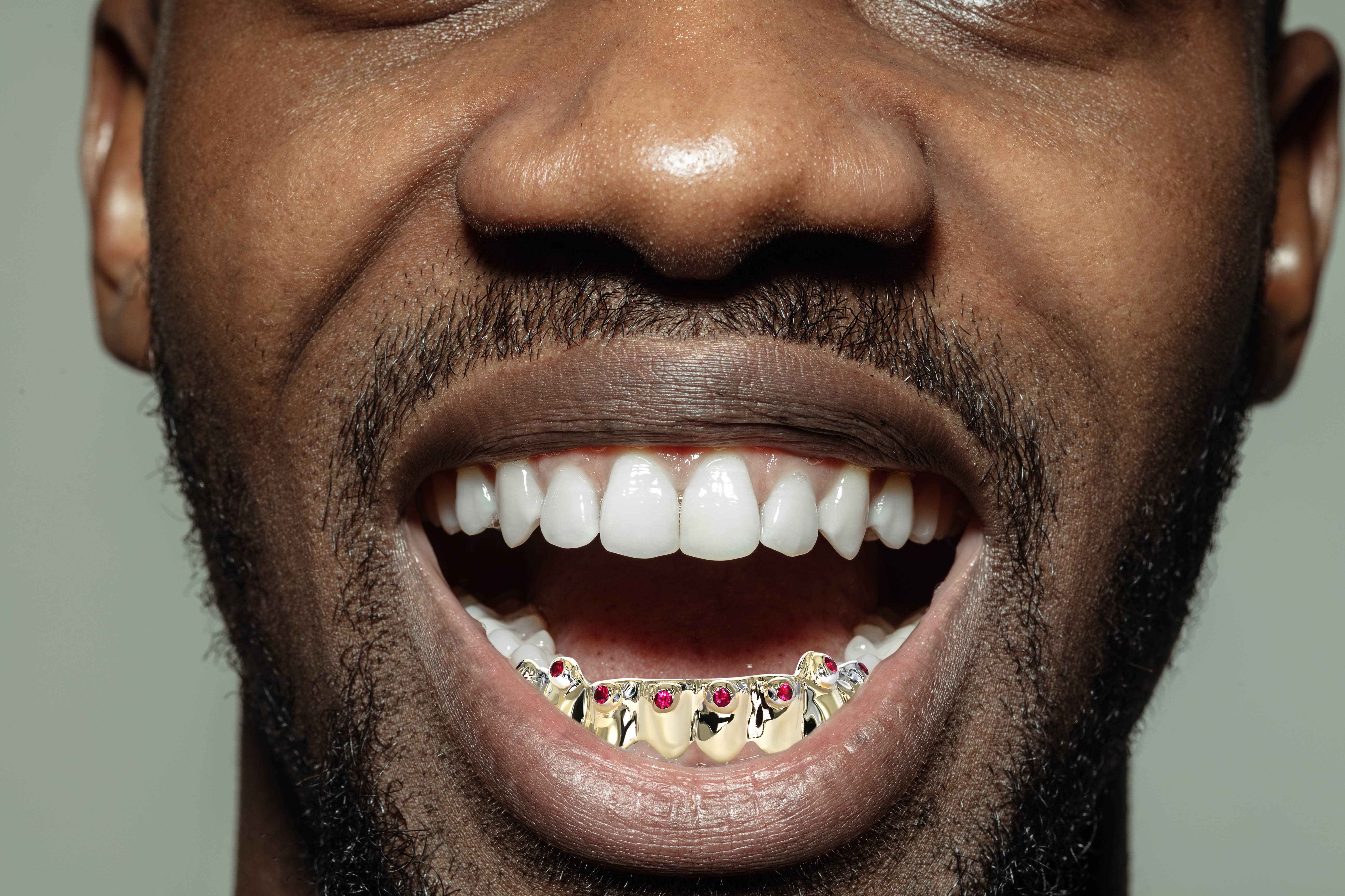 8 Teeth Diamond Ruby Grillz for Men & Women - Luxury Gold Plated Hip Hop Grillz for Parties & Performances