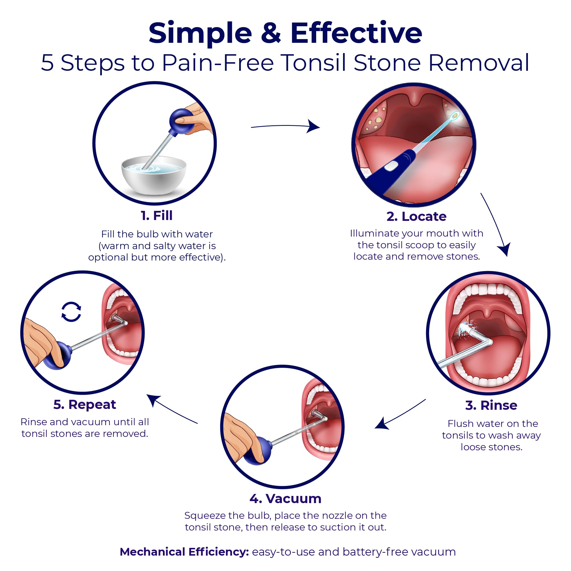 Oravix 3-in-1 Tonsil Stone Removal Kit - Tonsil Stone Vacuum Suction Tool, Extractor & Cupping Device for Bad Breath Relief | Safe & Effective Oral Care Solution for Tonsilloliths Removal at Home
