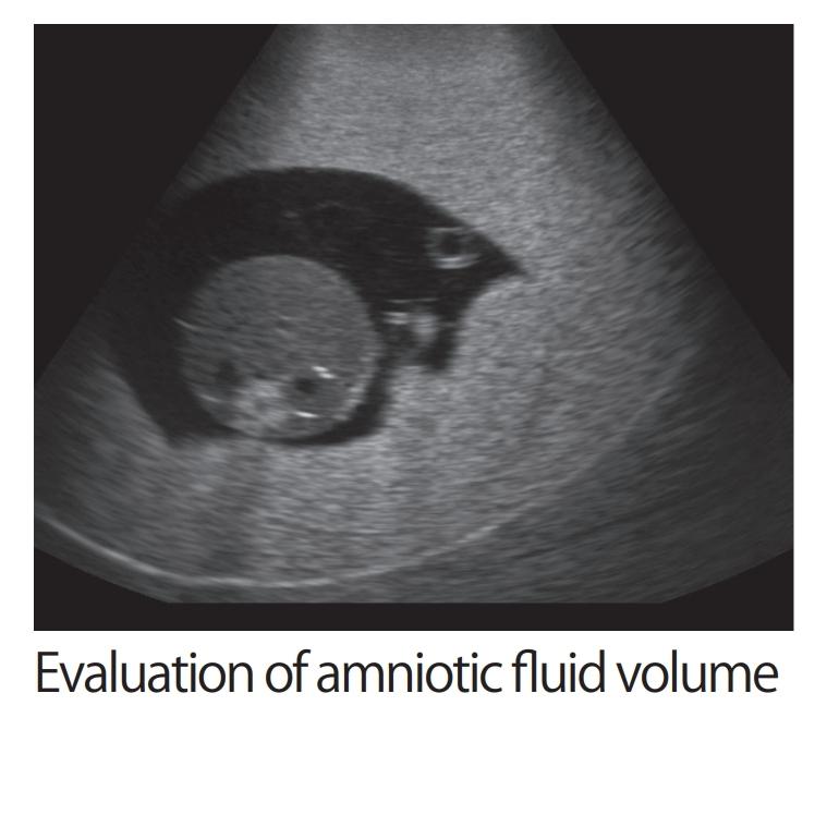 Fetal Ultrasound Training Phantom - High-Quality SPACE FAN ST Model for Medical Education & Diagnostic Practice | Perfect for OB/GYN Simulation & Sonography Training