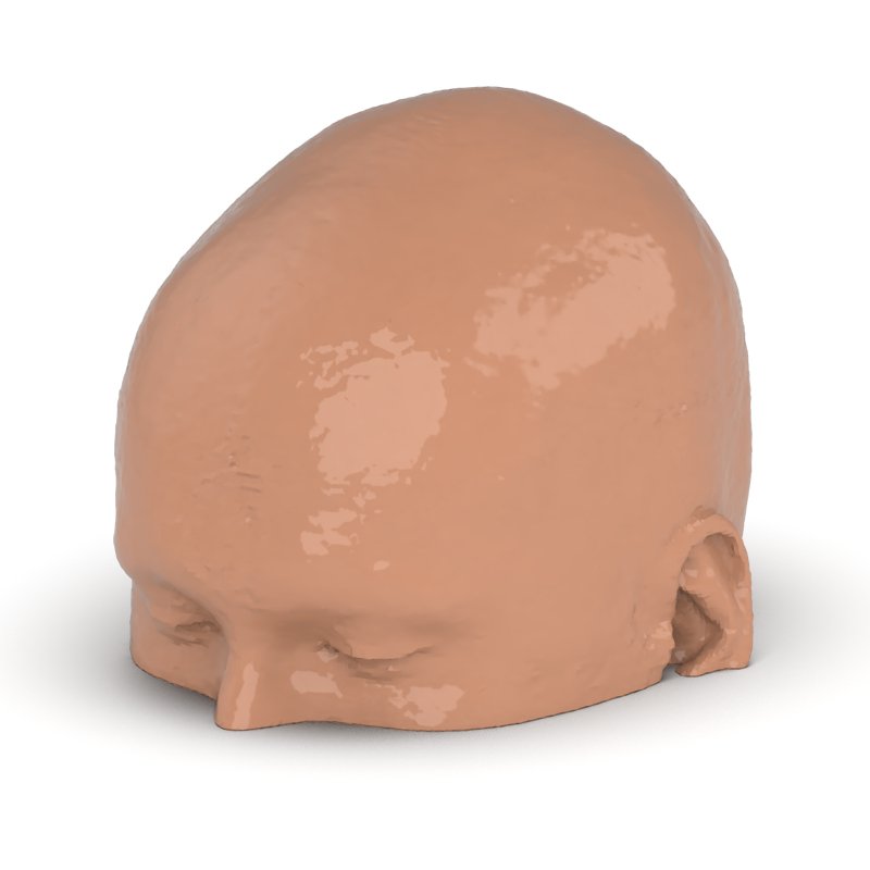 CTA AVM Head Phantom for CT Scan & X-Ray Training - Medical Imaging Practice, Radiology Education & Diagnostic Testing Simulation