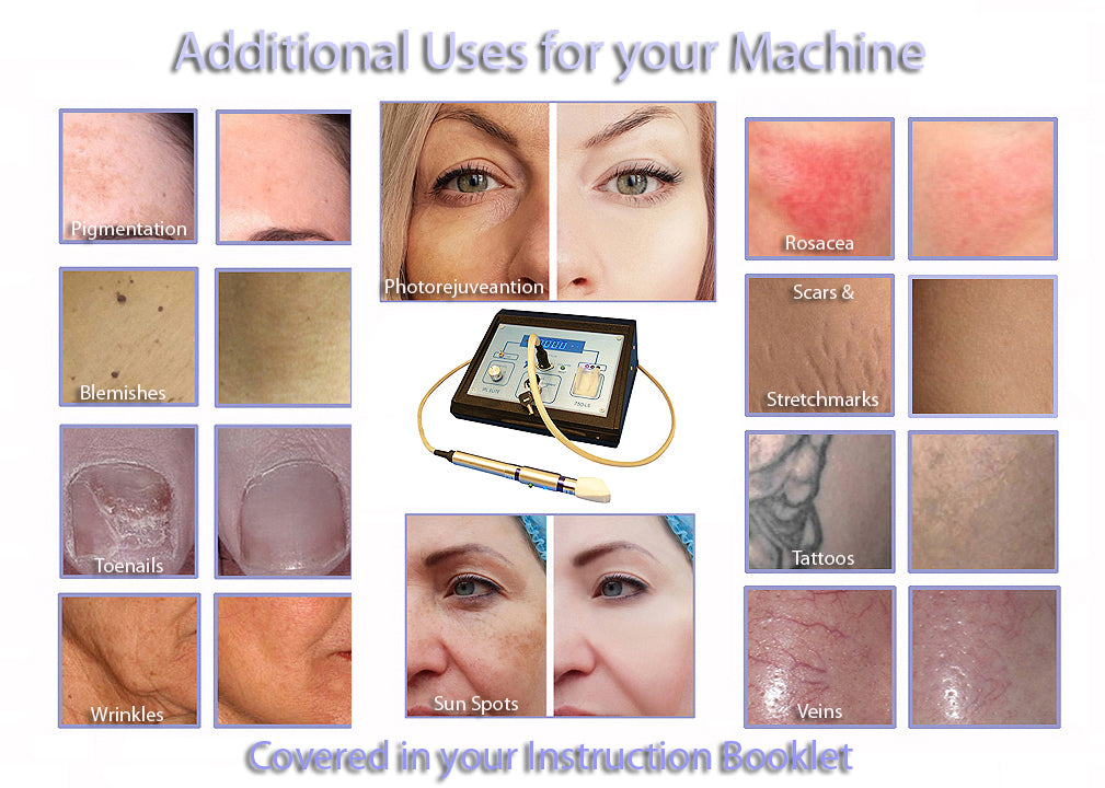 IPL750 Scar & Stretch Mark Removal Device - Professional Intense Pulsed Light Therapy Machine for Skin Rejuvenation - At-Home & Salon Use for Face & Body Treatment