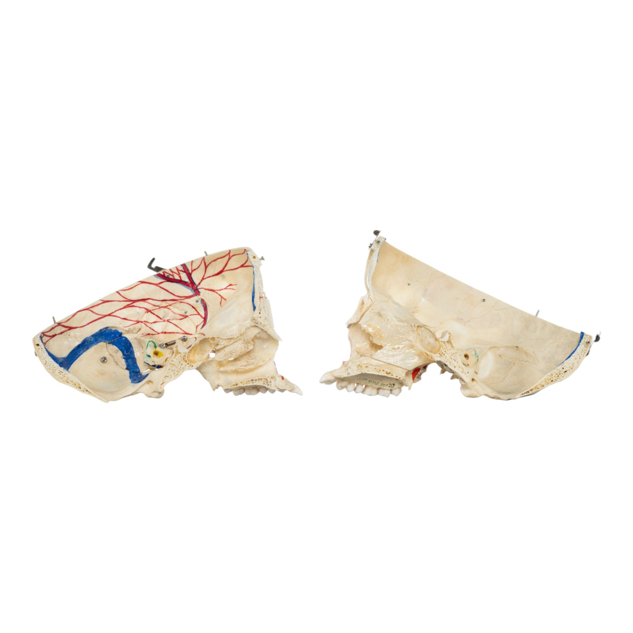Authentic Real Human Skull for Medical Study - Perfect for Anatomy Education, Forensic Research & Halloween Decor