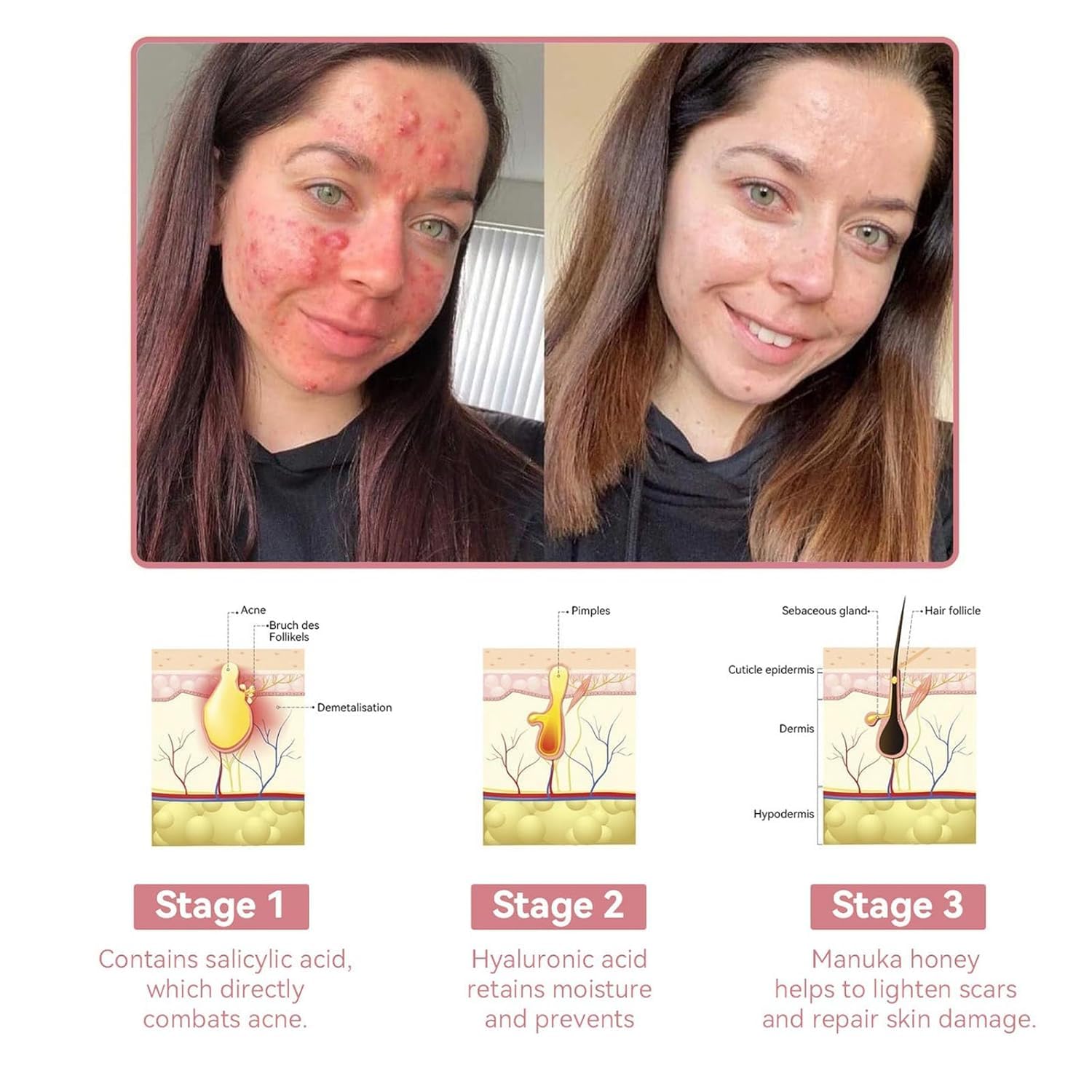 Coenzyme Q10 Collagen Jelly Cream - Intense Moisturizing Skin Care for Daily Use