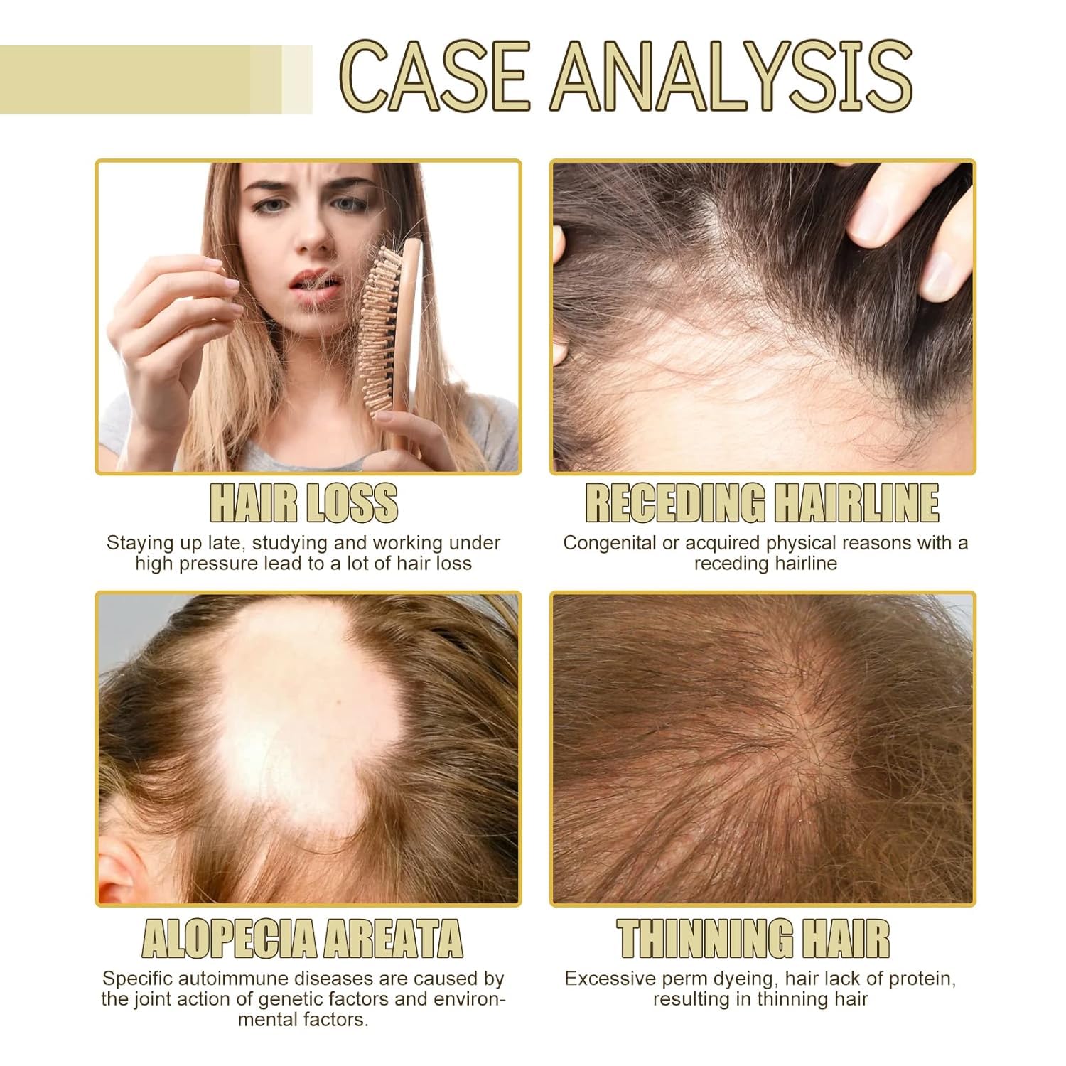 Organic Vegan Hair Growth Oil with Castor & Argan Oil - Natural Treatment for Dry, Damaged & Thin Hair - Promotes Thicker, Healthier Locks - Perfect for Daily Scalp Massage & Overnight Hair Repair