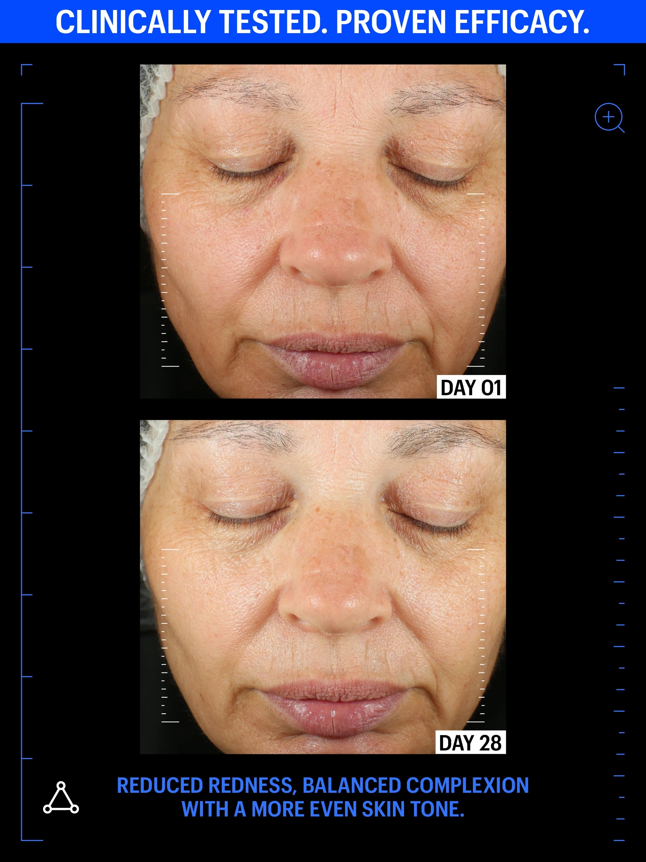 Copper Tripeptide & Ectoin Advanced Repair Serum for Face - Anti-Aging Skin Care Treatment for Wrinkles, Fine Lines & Hydration - Perfect for Night Routine & Post-Procedure Recovery