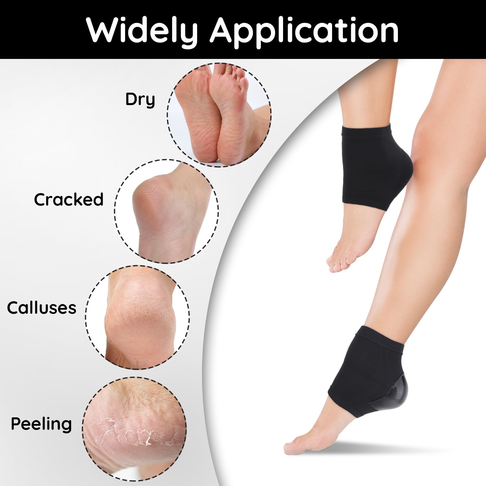 Segbeauty 12-Pack Heel Moisturizing Socks for Women - 6 Pairs Silky Gel-Lined Toeless Foot Socks for Dry, Cracked Heels | Overnight Moisture Therapy | Non-Slip SPA Socks for Foot Care & Relaxation | Perfect for Nighttime Use, Travel & Home Spa Treatments