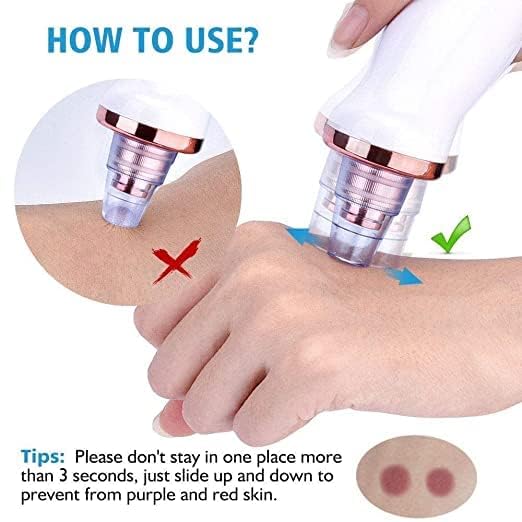 DOZERA Professional Acne Treatment Kit - Blackhead & Pore Vacuum Cleaner, Pimple Extractor Tool for Clear & Smooth Skin | Perfect for Home Facial Care & Daily Skincare Routine