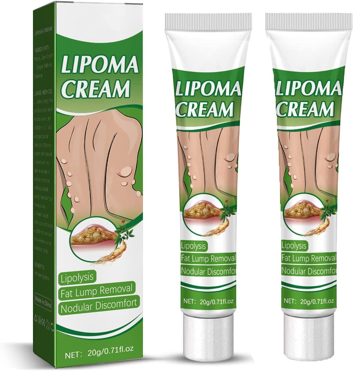 LipomaCure Soothing Ointment - 2 Pack Lump Removal Cream for Lipomas | Natural Lipoma Treatment for Arms, Legs & Body | Fast-Acting Lumps Relief Solution for Home & Travel Use